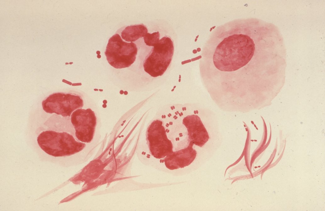 Neisseria gonorrhoeae.