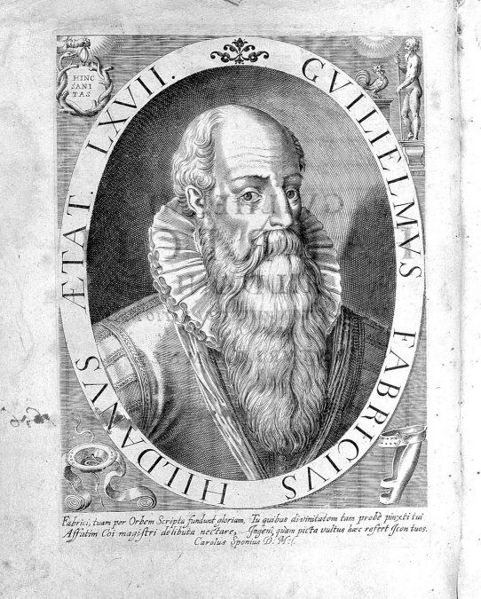 Fabricius Hildanus, padre de la cirugía alemana a la edad de 67 años, según un grabado de la época.