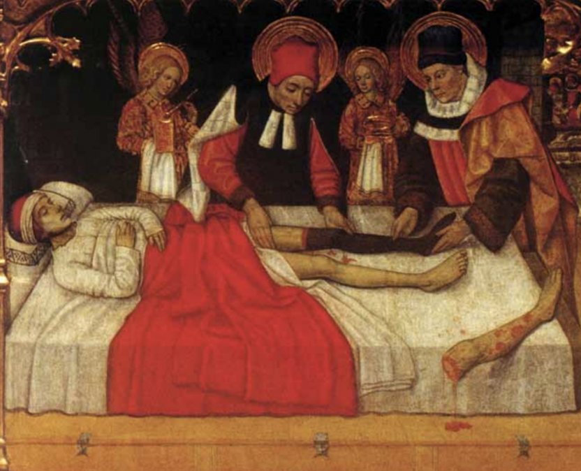                    Los santos Cosme y Damián trasplantan una pierna a un enfermo • (Detalle del Retablo de los santos Nin y Non, también llamados Adbón y Senén).      