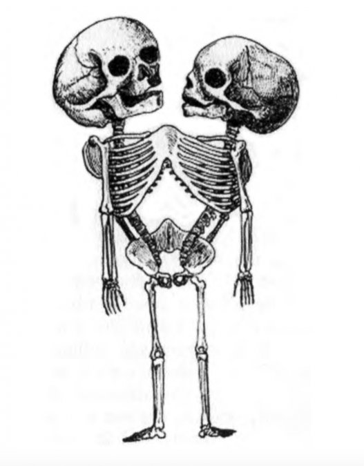 El esqueleto de las hermanas Parodi según el artículo de Étienne Serres.