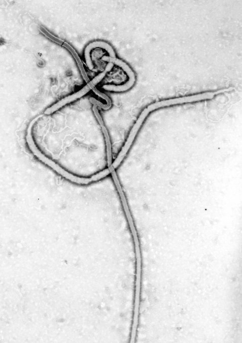 Microscopía electrónica de un virión de Ebolavirus. 